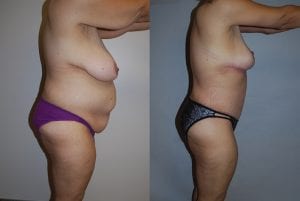Before and After Image