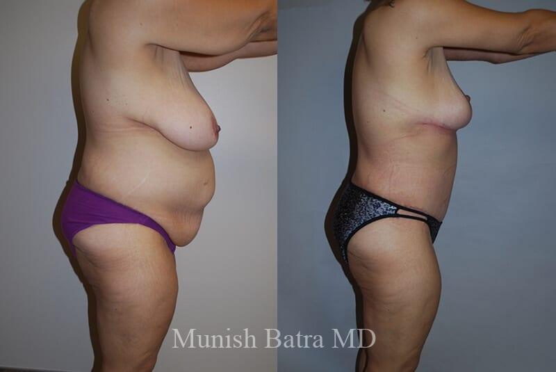 Before and After Image