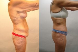 Before and After Image