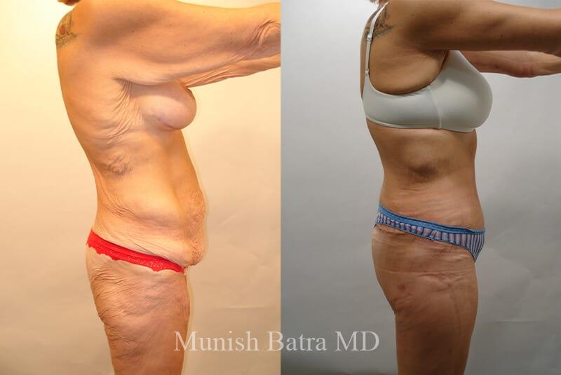 Before and After Image