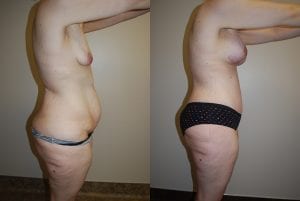 Before and After Image