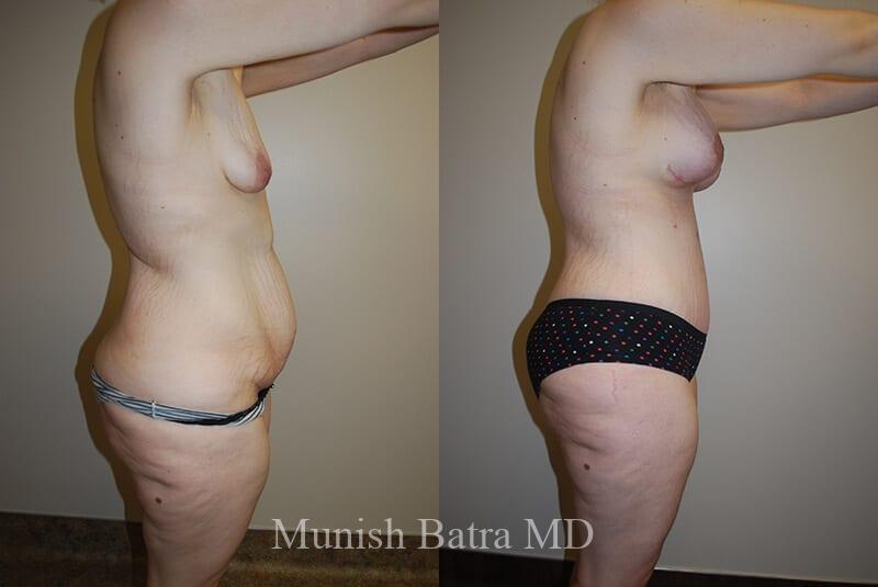 Before and After Image
