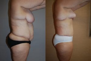 Before and After Image