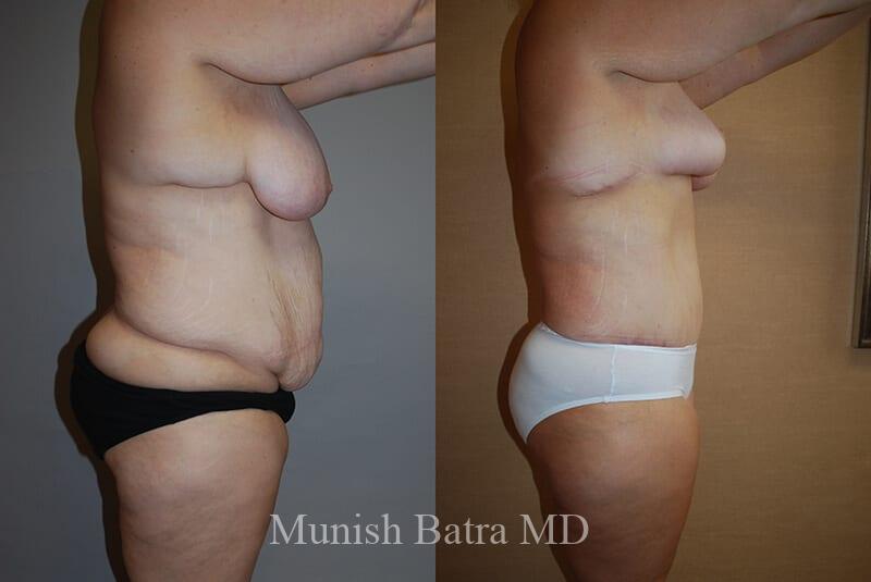 Before and After Image