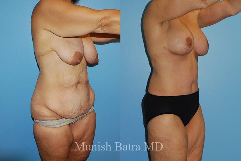 Before and After Image