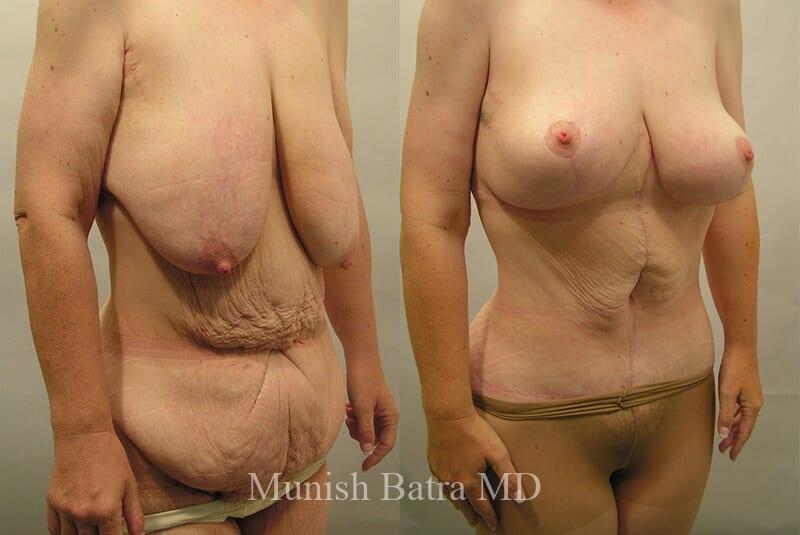 Before and After Image