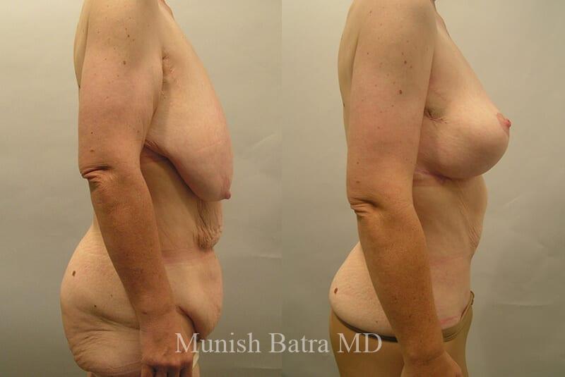 Before and After Image