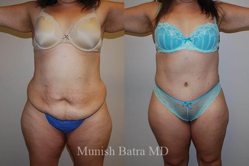 Before and After Image