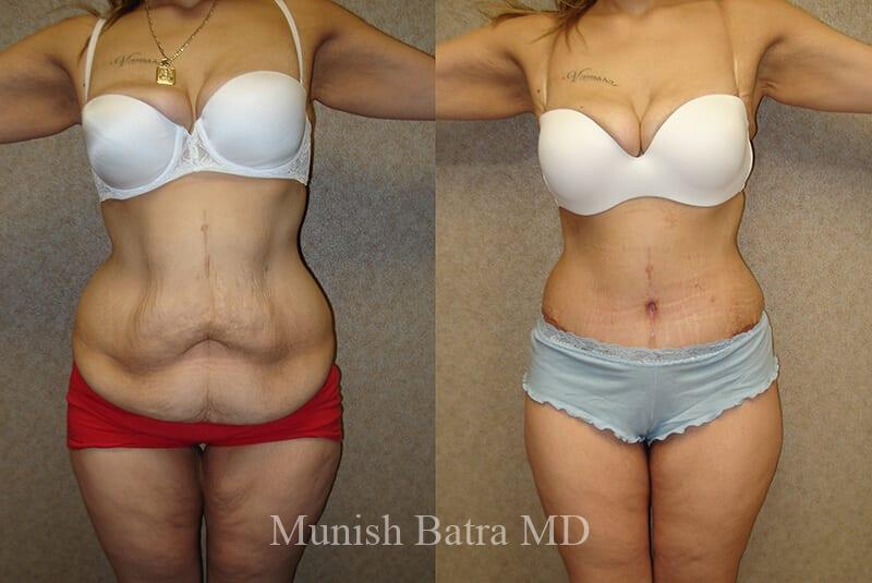 Before and After Image