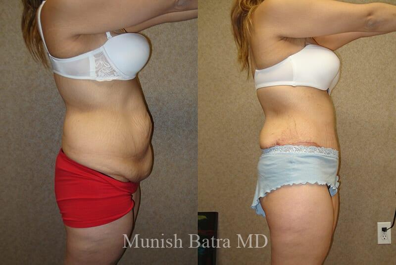 Before and After Image
