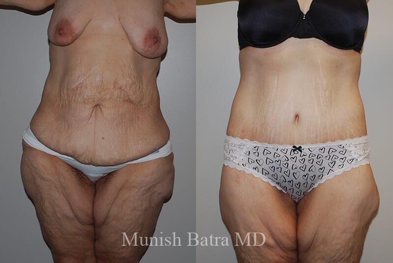 Before and After Image