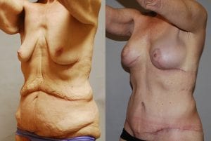 Before and After Image