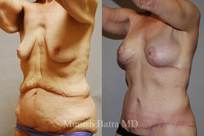 Before and After Image