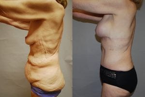 Before and After Image