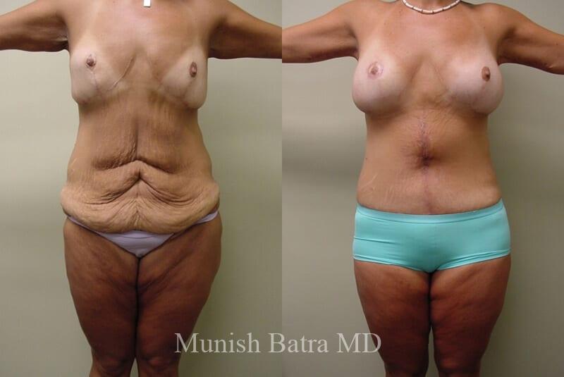 Before and After Image