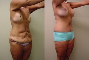 Before and After Image