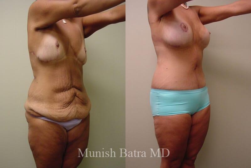 Before and After Image