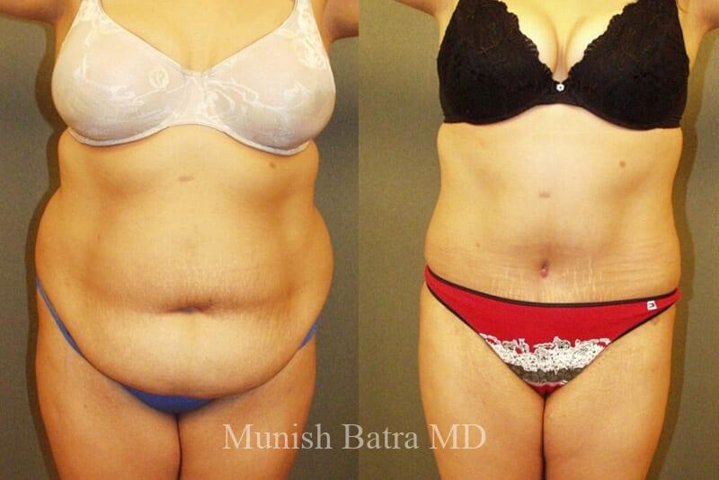 Before and After Image