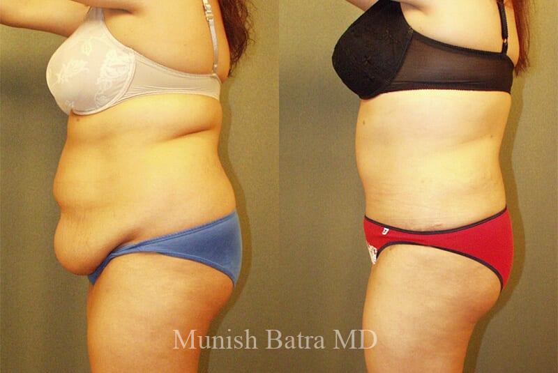 Before and After Image