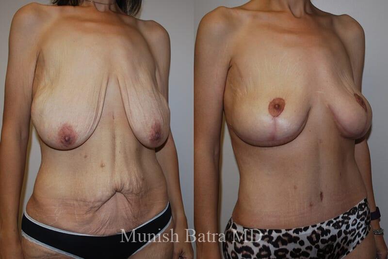 Before and After Image