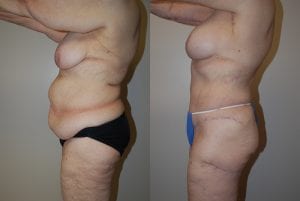Before and After Image
