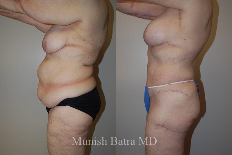 Before and After Image