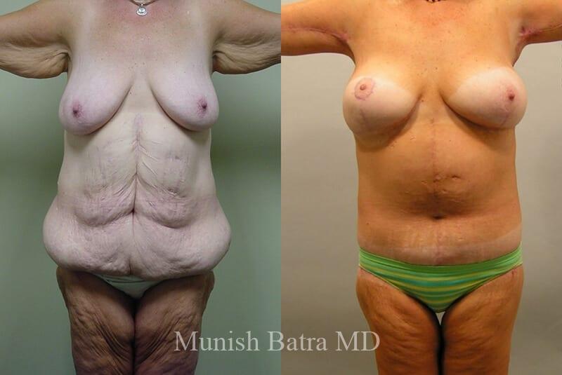 Before and After Image