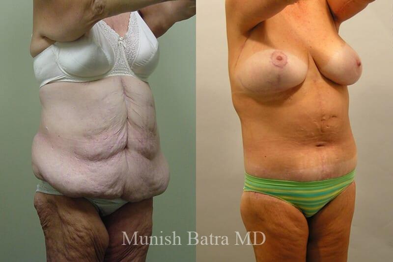 Before and After Image