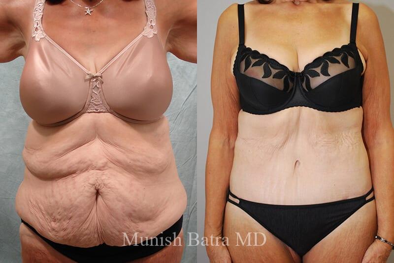 Before and After Image