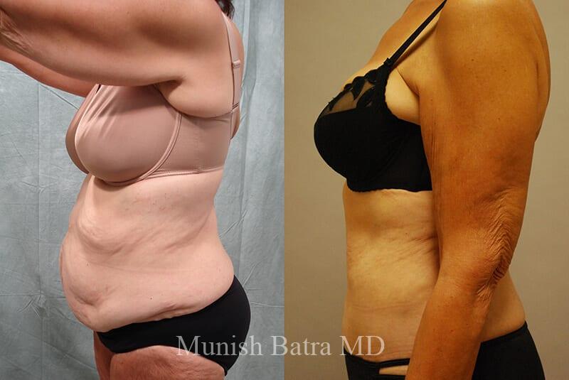 Before and After Image