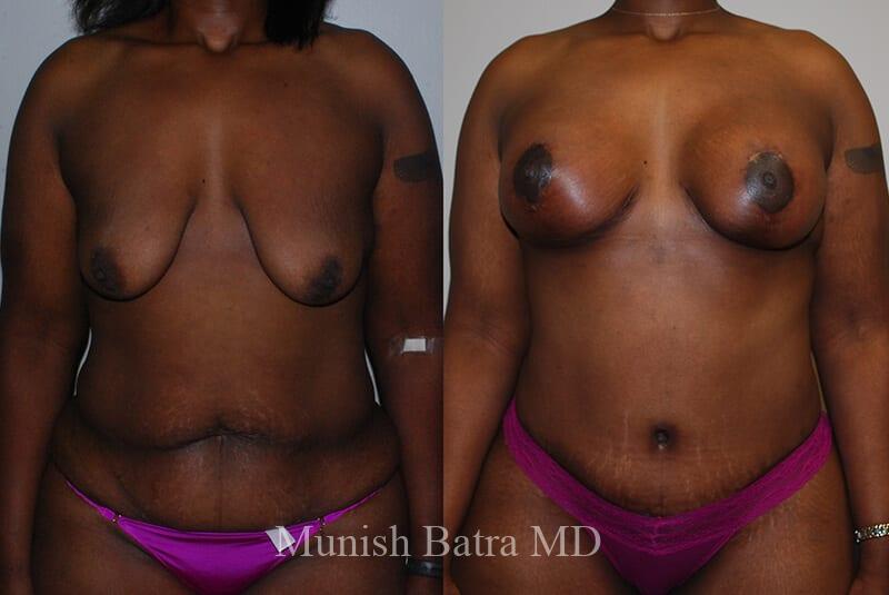 Before and After Image