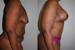 Before and After Image