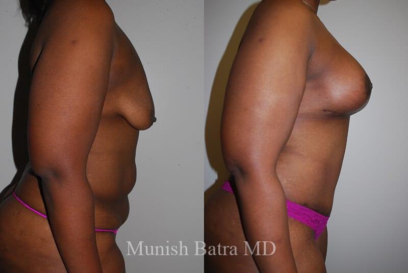 Before and After Image