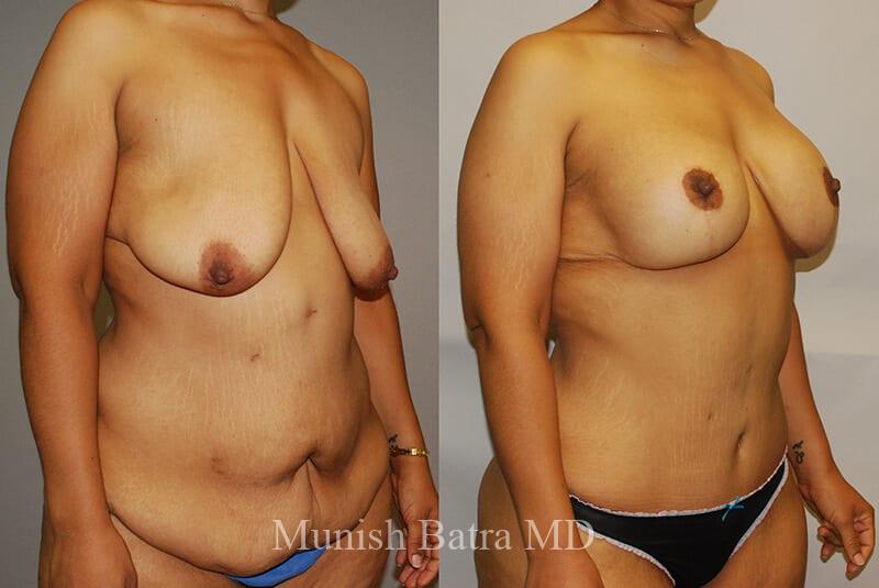 Before and After Image