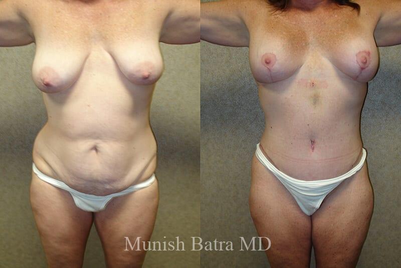 Before and After Image