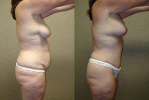 Before and After Image