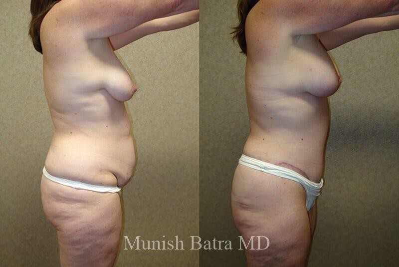 Before and After Image