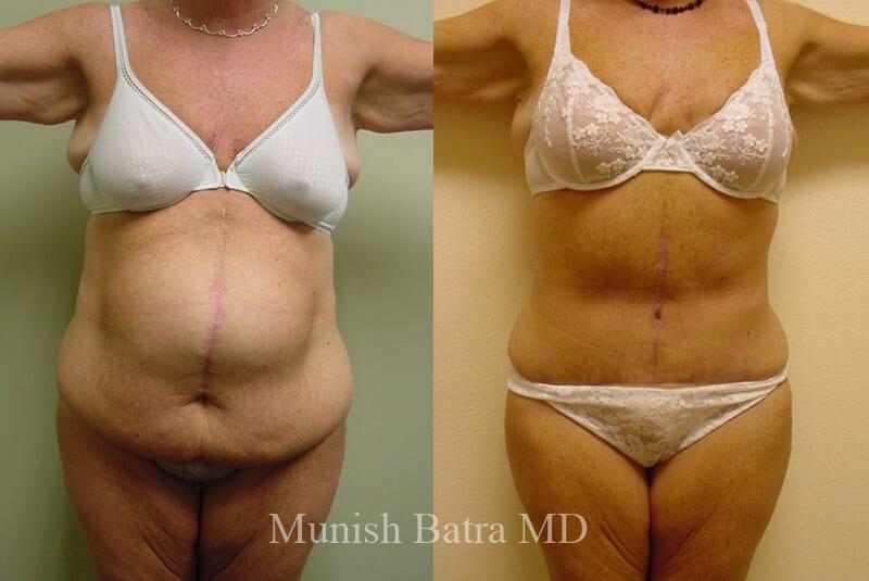 Before and After Image