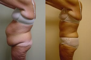 Before and After Image