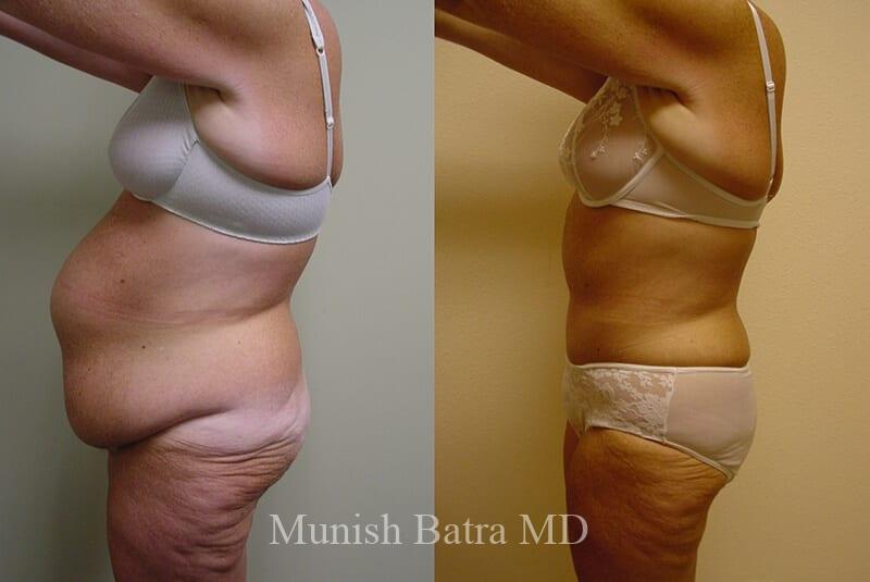 Before and After Image