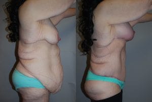 Before and After Image