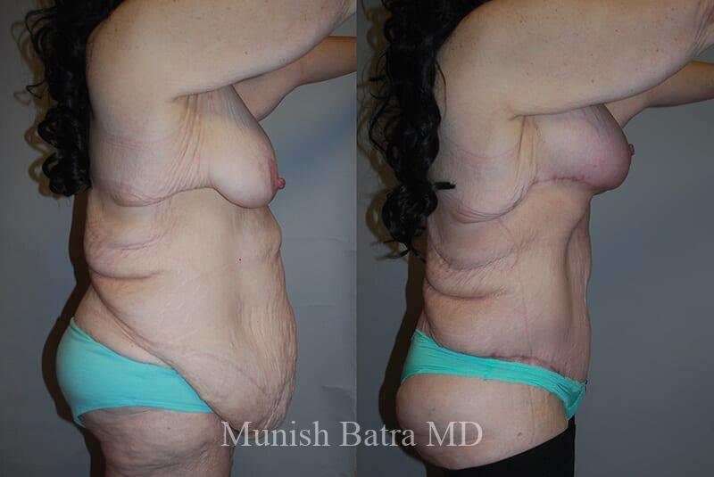 Before and After Image