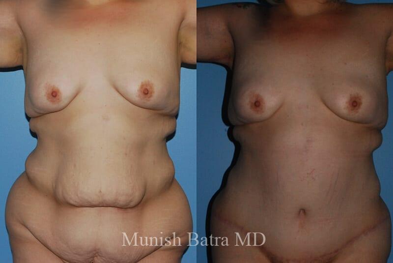 Before and After Image