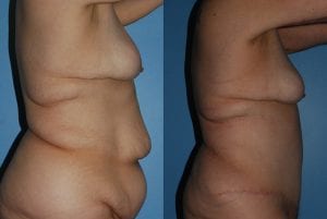 Before and After Image