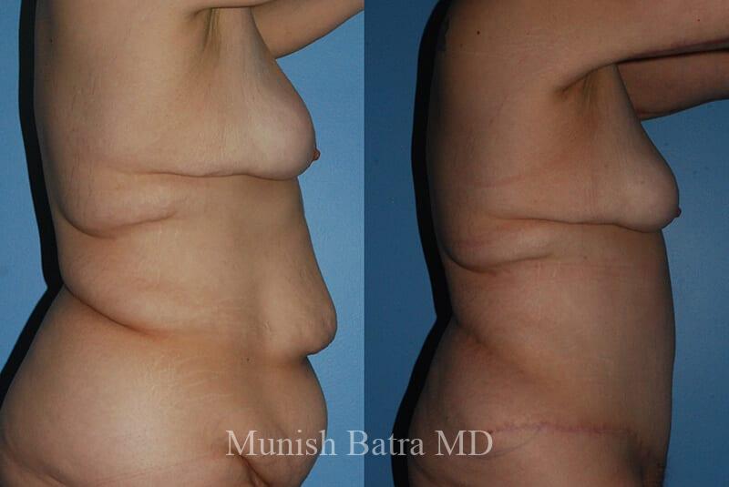 Before and After Image