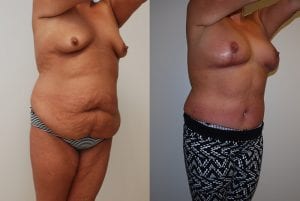 Before and After Image
