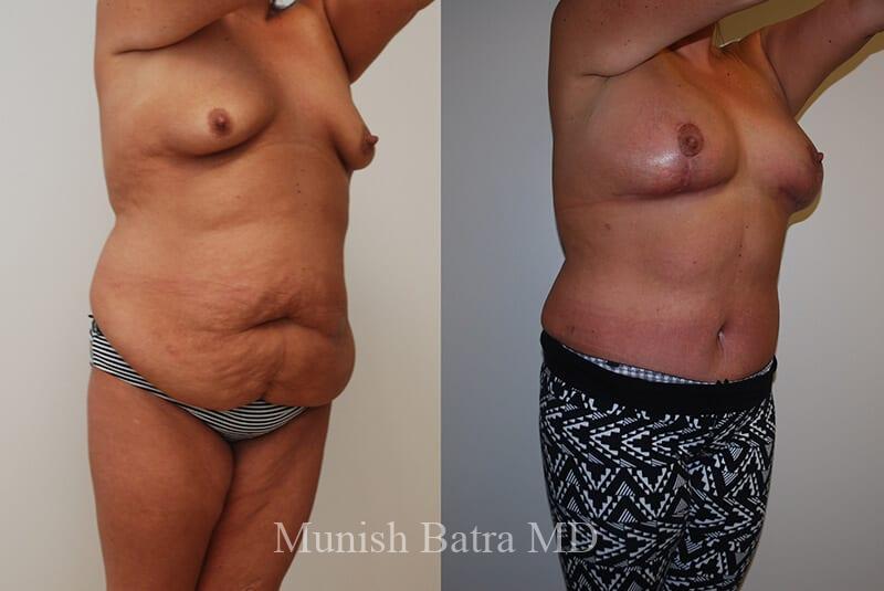 Before and After Image
