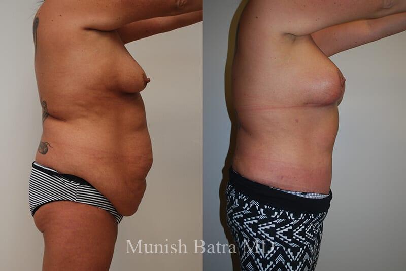 Before and After Image