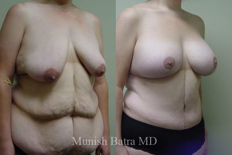 Before and After Image
