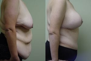 Before and After Image
